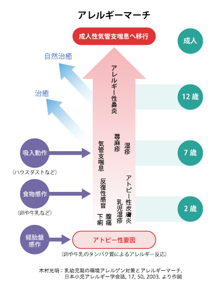 アレルギーマーチ